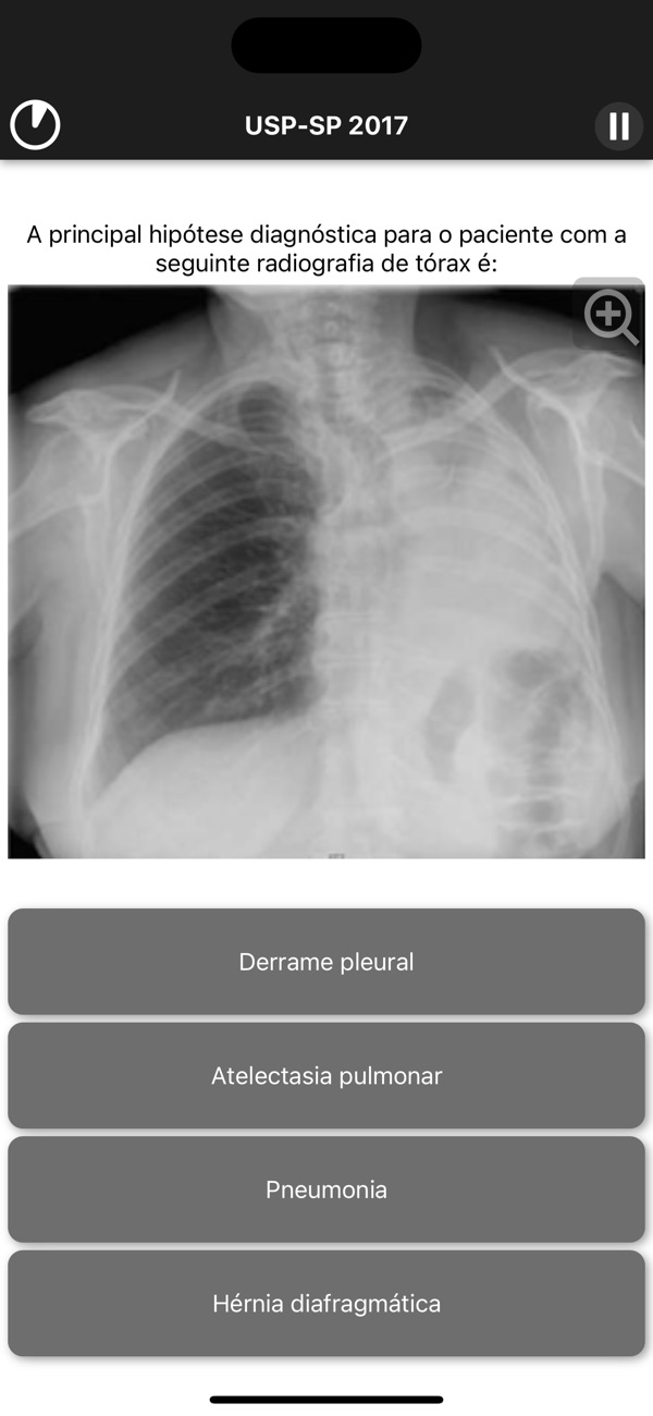 R1 Quiz: questão de prova de residência com radiografia de tórax e alternativas